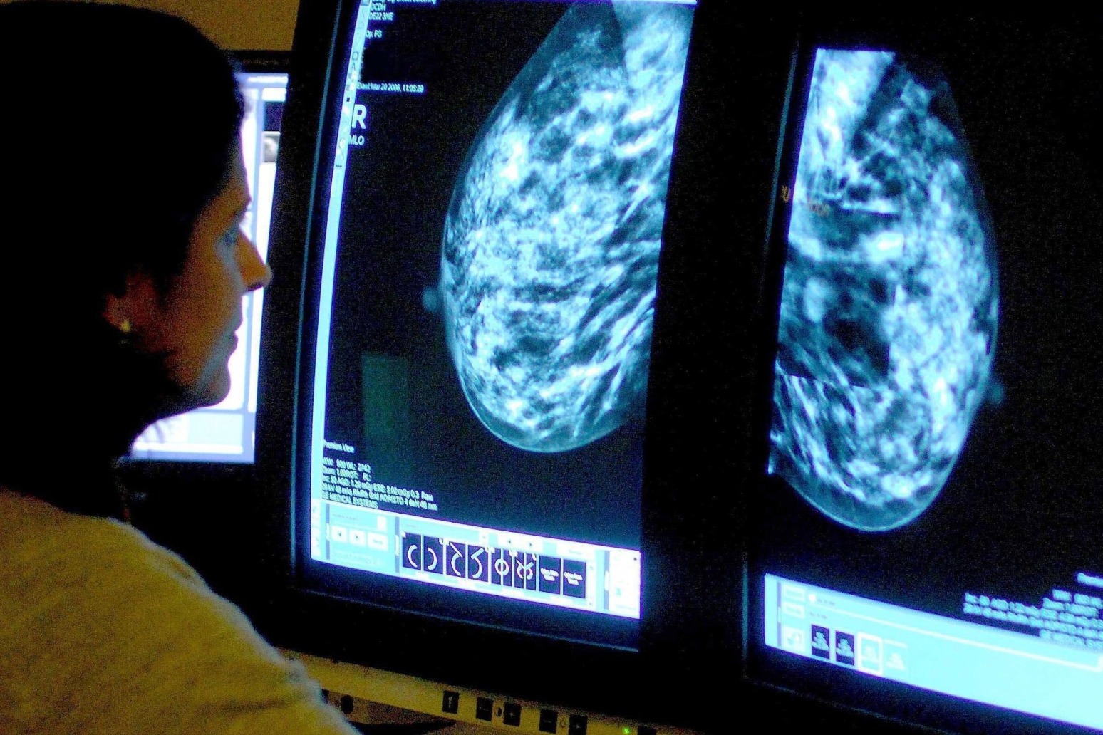Almost 300,000 women to be offered drug which can reduce risk of breast cancer 