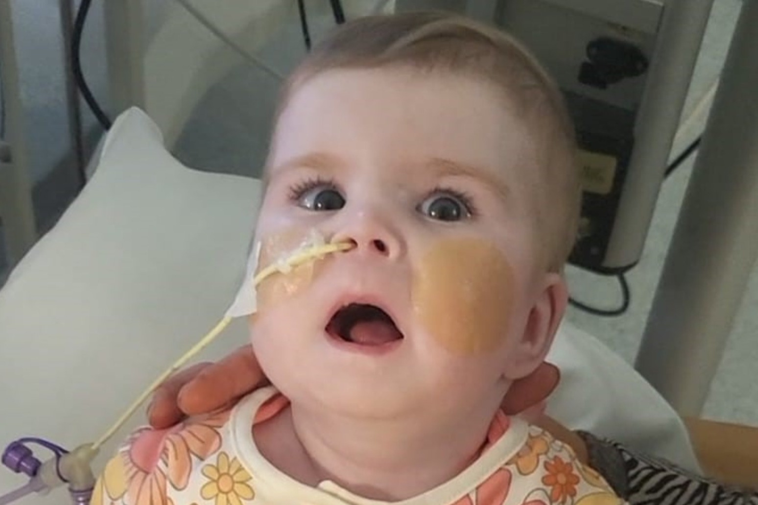 Critically ill baby’s parents lose another round of life-support treatment fight 